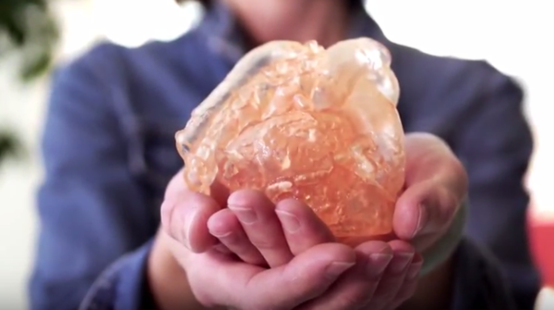 Innovative 3-D technology helps prepare surgeons for tough operations - KREM.com